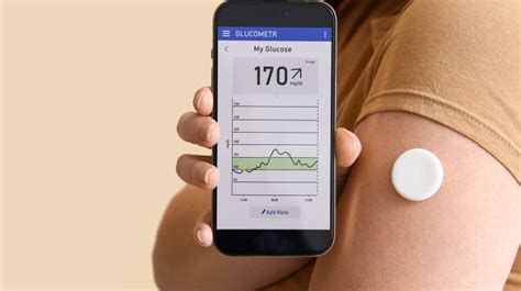 Does a Continuous Glucose Monitor Hurt?