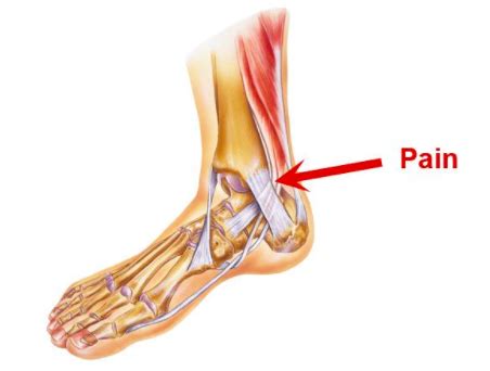 Inner Ankle Pain When Running